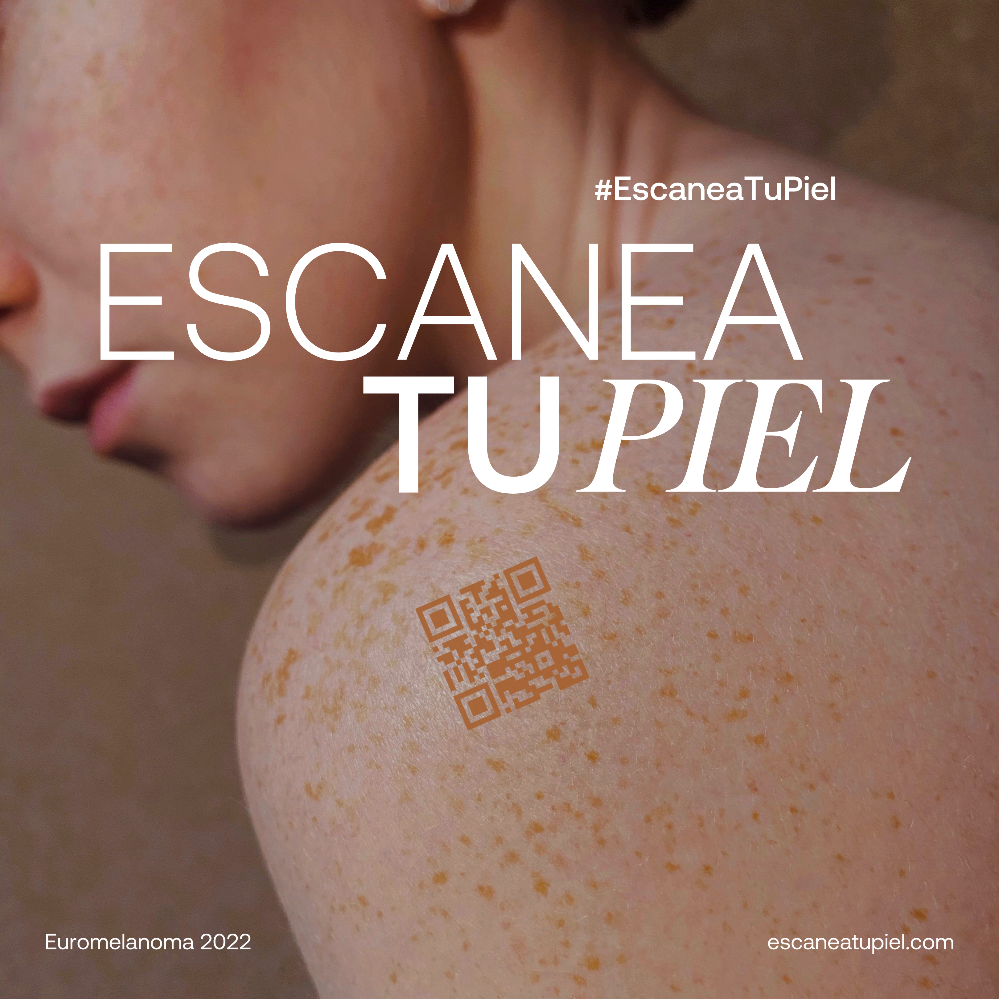 Campaña Euromelanoma 2022 'Escanea tu piel'