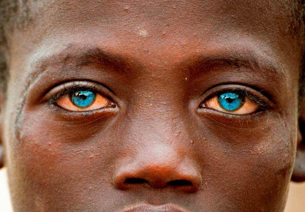 Ojos azules, pobreza